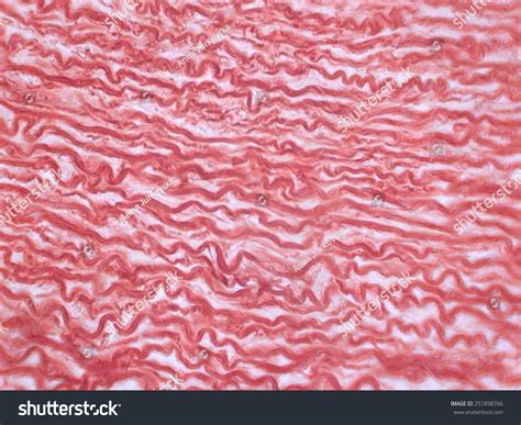 Collagen Fibers Histology Sample Stock Photo 251898766 - Shutterstock