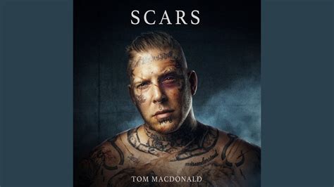 Scars - YouTube Music