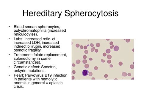 PPT - Hematology-Oncology Review Session PowerPoint Presentation, free ...