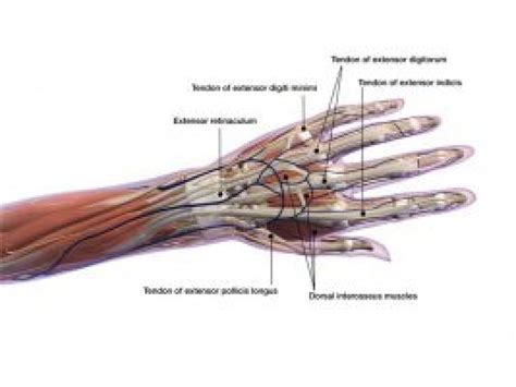 Intrinsic And Extrinsic Muscles Of The Hand