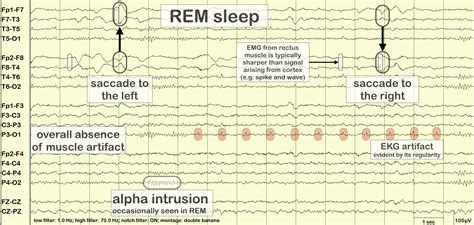 rapid eye movement (REM) sleep