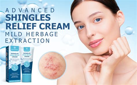 Roycederm Shingles Pain Relief Cream - Fast Acting Shingles Treatment ...