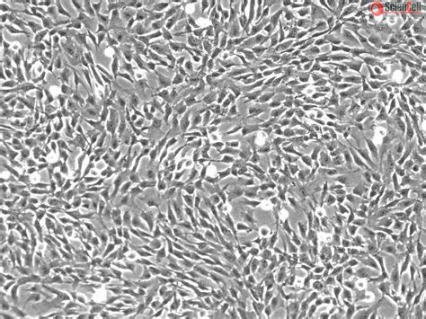 Human Anulus Fibrosus Cells