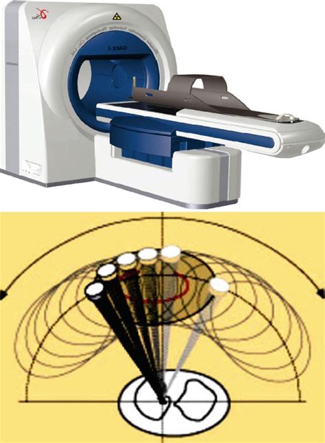 Stereotactic Body Radiation Therapy Systems | Radiology Key