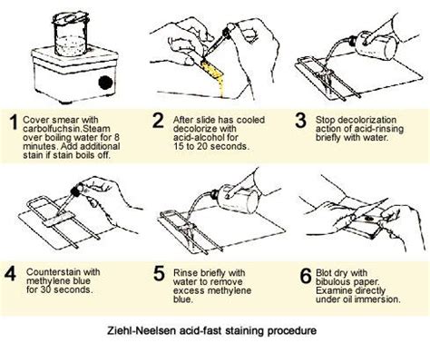 Ziehl-Neelsen acid-fast staining procedure | Medical Laboratories