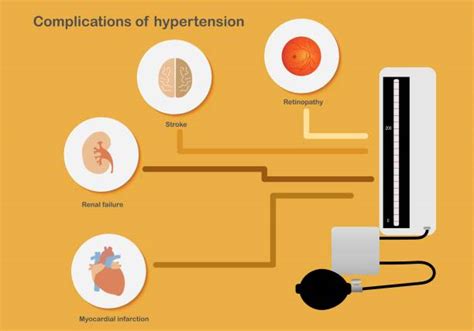 Hypertension And Ckd | lupon.gov.ph