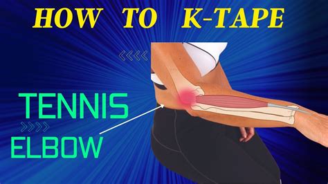 Does Kt Tape Provide Relief For Tennis Elbow Pain?