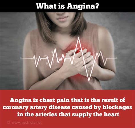 Chest Pain - Angina