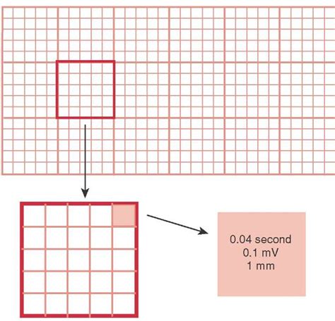 The Normal ECG