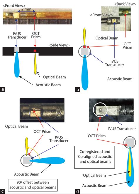 Advances in Intravascular Ultrasound - Indian Journal of Cardiovascular Disease in Women