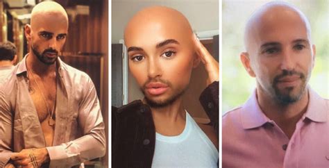 Quiz: Can you guess which celebs have been put through the bald filter?