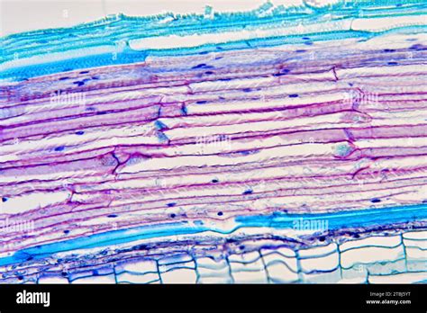 Sieve tube elements of Bryonia sp. Optical microscope X200 Stock Photo - Alamy