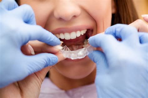 6 Invisalign Tips Every Orthodontic Patient Should Know