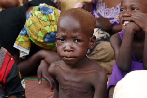 Yobe has the most cases of malnutrition in Nigeria, says WFP | TheCable