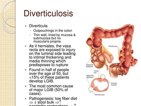 PPT - Gastrointestinal Bleeding PowerPoint Presentation - ID:547157