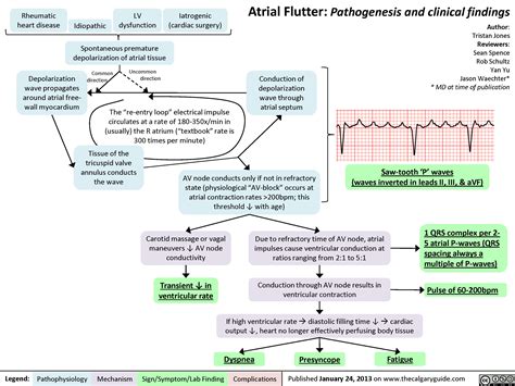 Atrial Flutter (1) | Calgary Guide