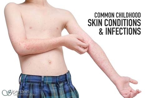 A Handy Guide To Common Childhood Viral Skin Conditions