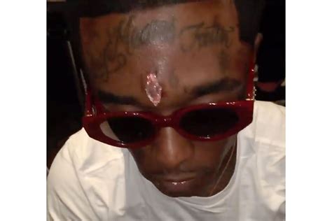 Why Lil Uzi Vert Wants to Have All Their Tattoos Removed