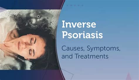 Inverse Psoriasis: Causes, Symptoms, and Treatments | MyPsoriasisTeam