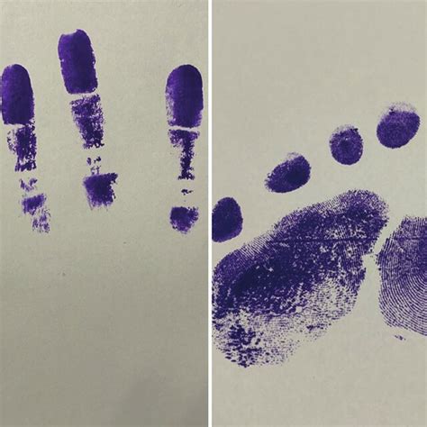 Dermatoglyphics of palms (a) and soles (b) b a | Download Scientific Diagram