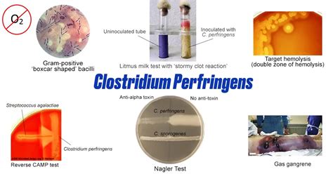 Clostridium Perfringens Gram Stain