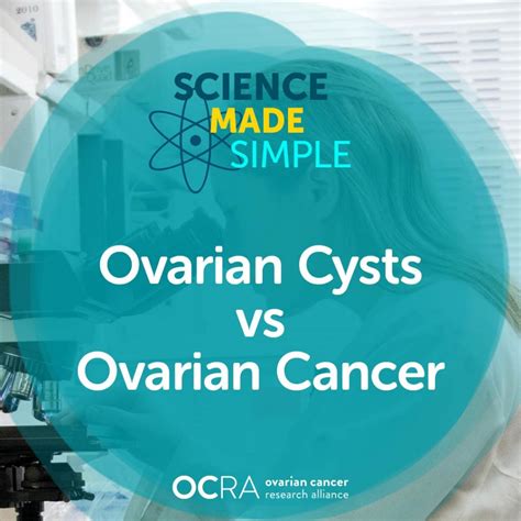 Difference Between Ovarian Cyst and Ovarian Cancer | OCRA