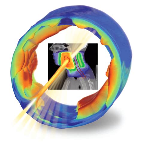 IBA Dosimetry: COMPASS