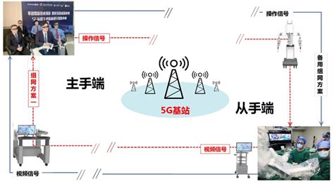 Breakthrough on Robot-assisted Laparoscopic Telesurgery with 5G Technology-Tianjin University: