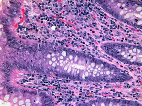 Human appendix H&E 40x | Tissue types, Celestial bodies, Human