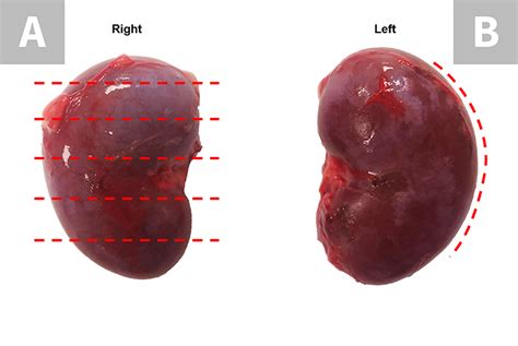 Image Gallery: Autopsy for the General Practitioner | Clinician's Brief