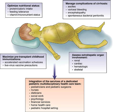 End Stage Liver Disease Concept Map - United States Map