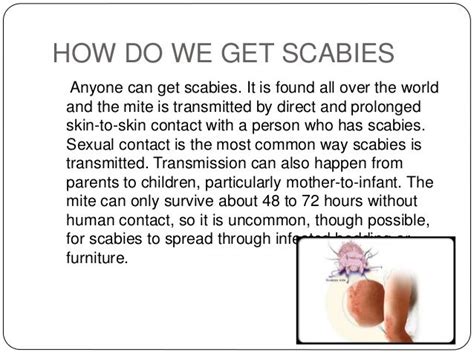 scabies symptoms images - pictures, photos