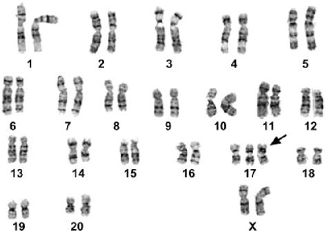 Random Karyotype