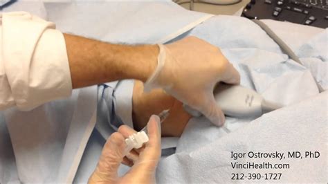 Hyaluronic Acid Injection to the Knee Joint #1 - YouTube