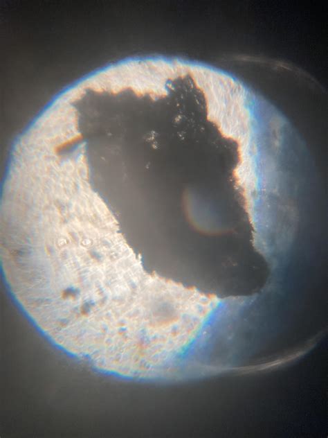 mite under microscope? : r/scabies