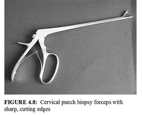 Colposcopy and treatment of cervical intraepithelial neoplasia: a beginners’ manual