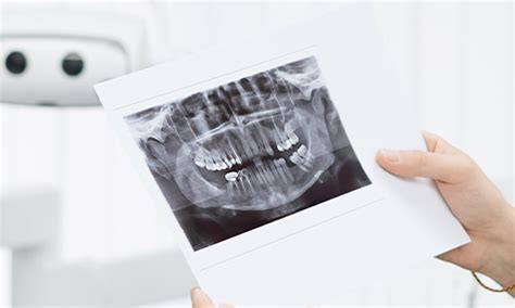 What is Dental Bone Resorption & How to Fix it? Tips