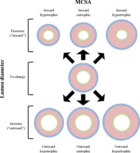 Role of resistance vasculature in the development and maintenance of hypertension in chronic ...