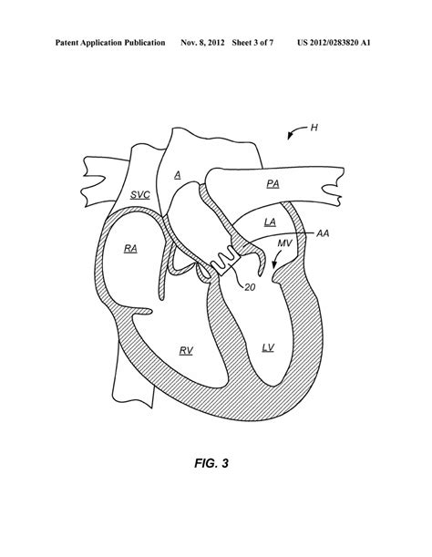 Unlabeled Heart Diagram - Cliparts.co