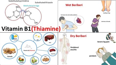 Benefits of Thiamine (Vitamin B1) » The Nutraceutical Database