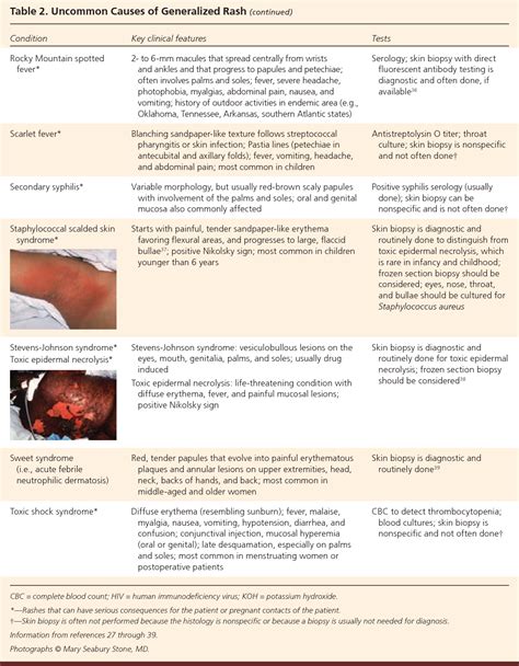 Table 1 from The generalized rash: part I. Differential diagnosis. | Semantic Scholar