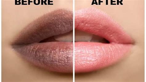 How to Get Pink Lips Overnight (Naturally & Quickly)- Female