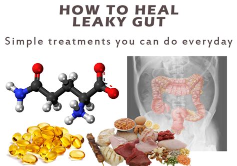 How to Heal Leaky Gut Syndrome | Symptoms | Treatments