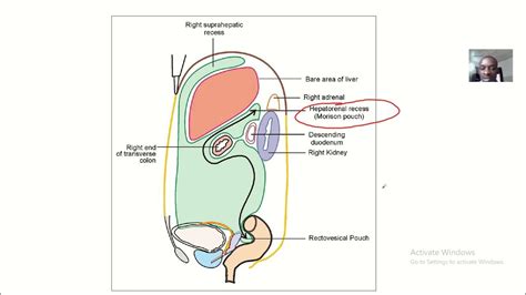 Morrison's pouch // Hepatoranal pouch and how blood fluid accumulates here in ascites - Anatomy ...