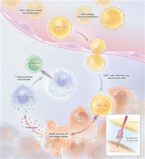 Cureus | Chimeric Antigen Receptor T-Cell Therapy: A Beacon of Hope in ...