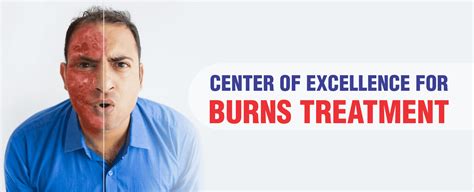 Burn Treatment and Surgery in India | Amandeep Hospital