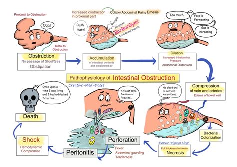 Acute intestinal obstruction: Pathophysiology - Creative Med Doses