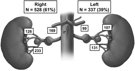 The contemporary management of renal artery aneurysms - Journal of Vascular Surgery