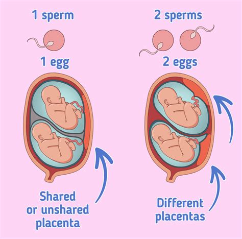 Difference Between Identical And Fraternal Twins In The Womb