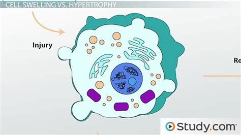 Hydropic Degeneration Causes & Significance | What Causes a Cell to Swell? - Lesson | Study.com